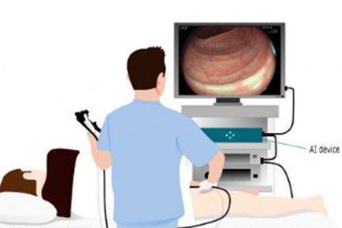 生6个月「废功」20%癌症检出率!pg电子模拟器柳叶刀惊曝:AI让医(图3) 生6个月「废功」20%癌症检出率!pg电子模拟器柳叶刀惊曝:AI让医(图3)