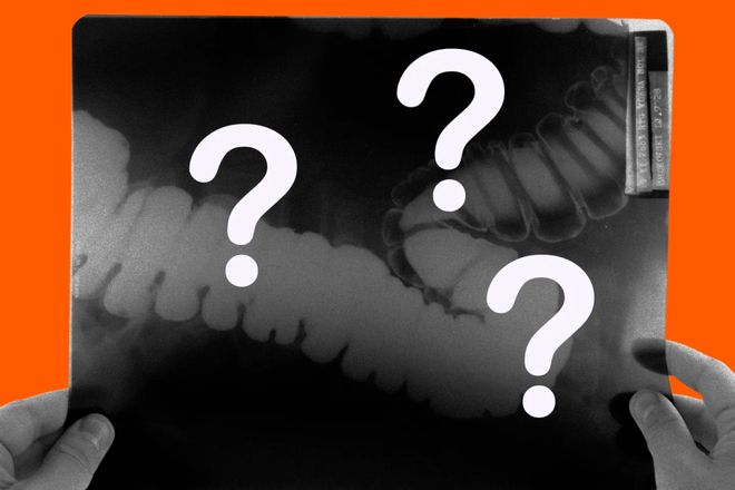 生6个月「废功」20%癌症检出率！pg电子模拟器柳叶刀惊曝：AI让医(图7)